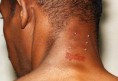 /album/piercing/img117-jpg/