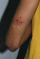 /album/piercing/img123-jpg/